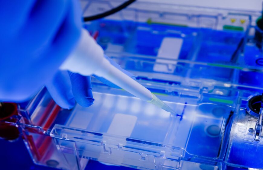 Scientist conducting the gel electrophoresis biological process as part of coronavirus research