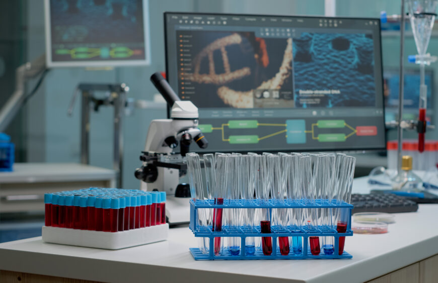 Medical test tubes with blood on desk in laboratory