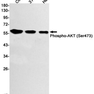 Anti-AKT antibody :: Rabbit AKT Monoclonal Antibody 0.1mL