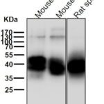 anti-NFKB1 antibody :: Rabbit NFkB Monoclonal Antibody 0.1mL