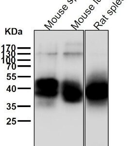 anti-NFKB1 antibody :: Rabbit NFkB Monoclonal Antibody 0.1mL