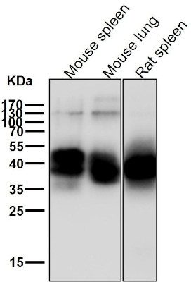 anti-NFKB1 antibody :: Rabbit NFkB Monoclonal Antibody 0.1mL