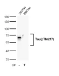 anti-Tau antibody :: Rabbit Tau Monoclonal Antibody 0.1mL