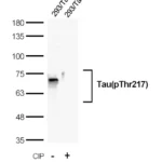 anti-Tau antibody :: Rabbit Tau Monoclonal Antibody 0.1mL