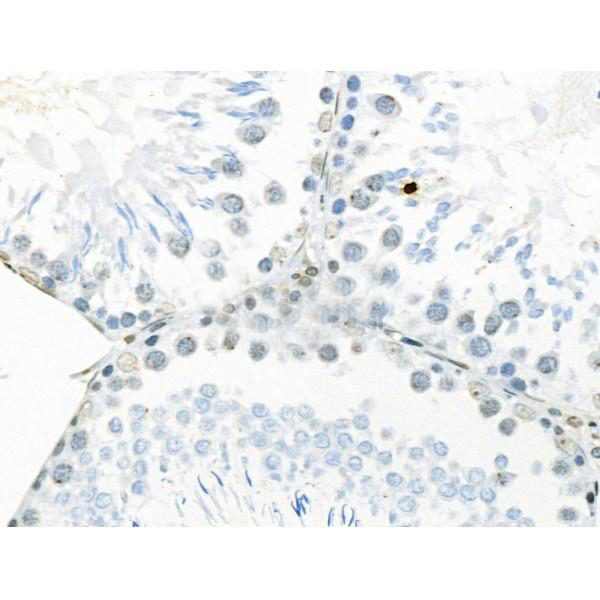 Rabbit anti-Human, Rat P53 Polyclonal Antibody 0.1mL