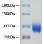 Recombinant Human IL-18R1/CD218a Protein 20 μg