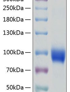 Recombinant Human IL-18R1/CD218a Protein 20 μg