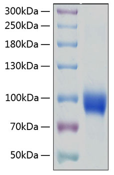 Recombinant Human IL-18R1/CD218a Protein 20 μg