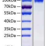 Recombinant Human IL-13RA1/CD213a1 Protein 100 μg