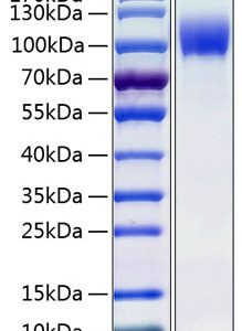 Recombinant Human IL-13RA1/CD213a1 Protein 100 μg