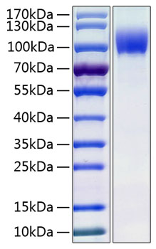 Recombinant Human IL-13RA1/CD213a1 Protein 100 μg