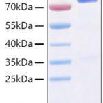 Recombinant Human IL-1R3/IL-1RAcP/IL1RAP Protein 100 μg