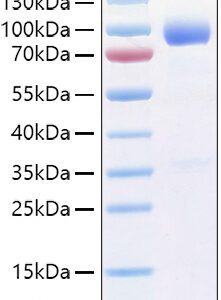 Recombinant Human IL-1R3/IL-1RAcP/IL1RAP Protein 100 μg