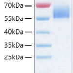 Recombinant Human IL-36R/IL-1Rrp2/IL1RL2 Protein 50 μg