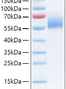 Recombinant Human IL-36R/IL-1Rrp2/IL1RL2 Protein 50 μg