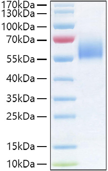 Recombinant Human IL-36R/IL-1Rrp2/IL1RL2 Protein 50 μg