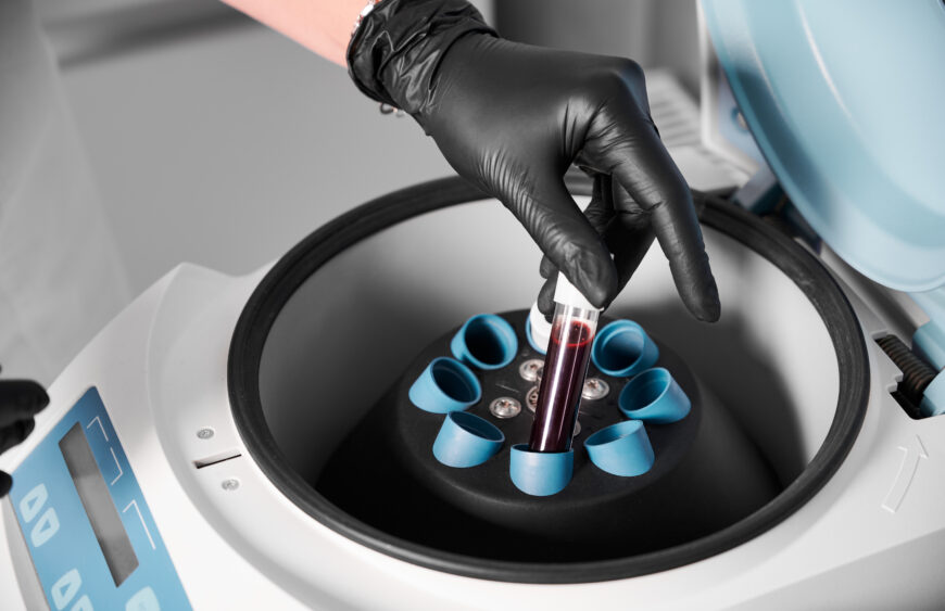 Choosing the Best Centrifuge for Your Lab