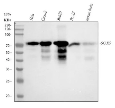 anti-SOX9 antibody :: Rabbit SOX9 Monoclonal Antibody- 0.03 mL