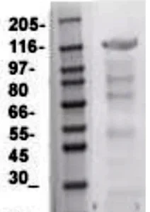 anti-CD117 (kit) antibody :: Rabbit CD117 (kit) Polyclonal Antibody