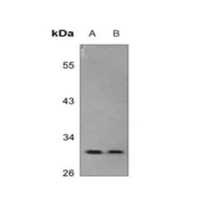anti-SCP3 antibody :: Rabbit SCP3 Polyclonal Antibody- 0.1 mg