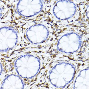 [KD Validated] Vimentin Rabbit pAb 100 μL