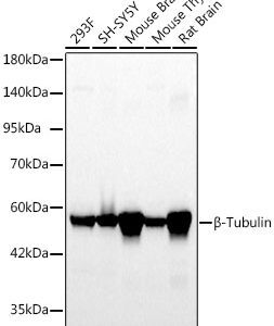 β-Tubulin Rabbit mAb 100 μL