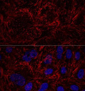 Septin 9 Rabbit pAb 100 μL