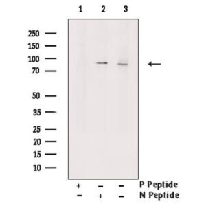Phospho-PI3K p85 alpha (Tyr452) Antibody 1 mg/Ml