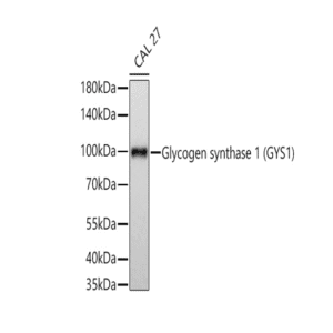 Glycogen synthase 1 (GYS1) Rabbit mAb 20 μL