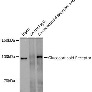 Glucocorticoid Receptor Rabbit mAb 20 μL