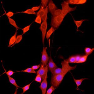 FPR2 Rabbit pAb-100 μL