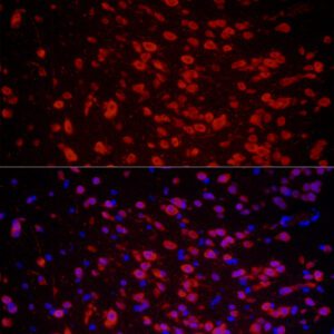 ELAVL3 Rabbit pAb / HUC; HUCL 100 μL