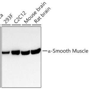 α-Smooth Muscle Actin (ACTA2) Rabbit mAb 20 μL
