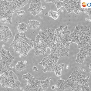 BT-474 Cells