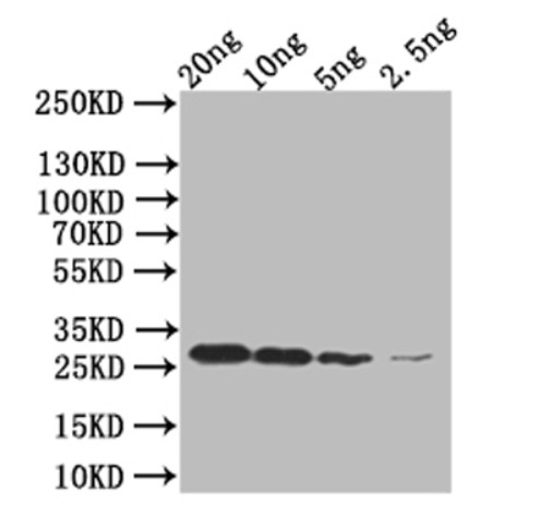 anti-mpt64 antibody :: Rabbit Mycobacterium tuberculosis Immunogenic protein MPT64 Polyclonal Antibody