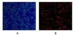 Live and Dead Cell Staining Kit