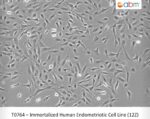 Immortalized Human Endometriotic Cell Line (12Z)