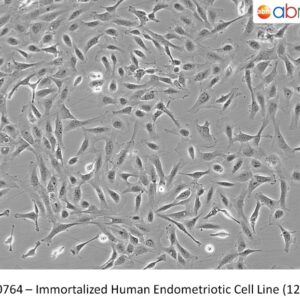 Immortalized Human Endometriotic Cell Line (12Z)