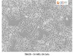 SK-MEL-24 Cells