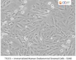 Immortalized Human Endometrial Stromal Cells - SV40