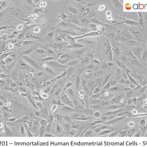 Immortalized Human Endometrial Stromal Cells - SV40