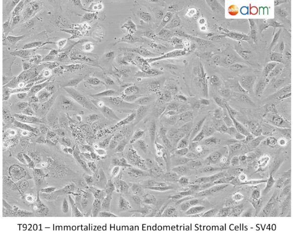 Immortalized Human Endometrial Stromal Cells - SV40